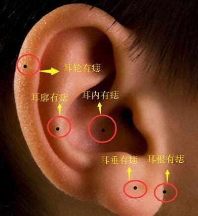 右耳上有痣|耳朵长痣的位置图解 耳朵长痣的位置图解有福气